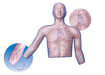 The model of primer insert artery(half torso